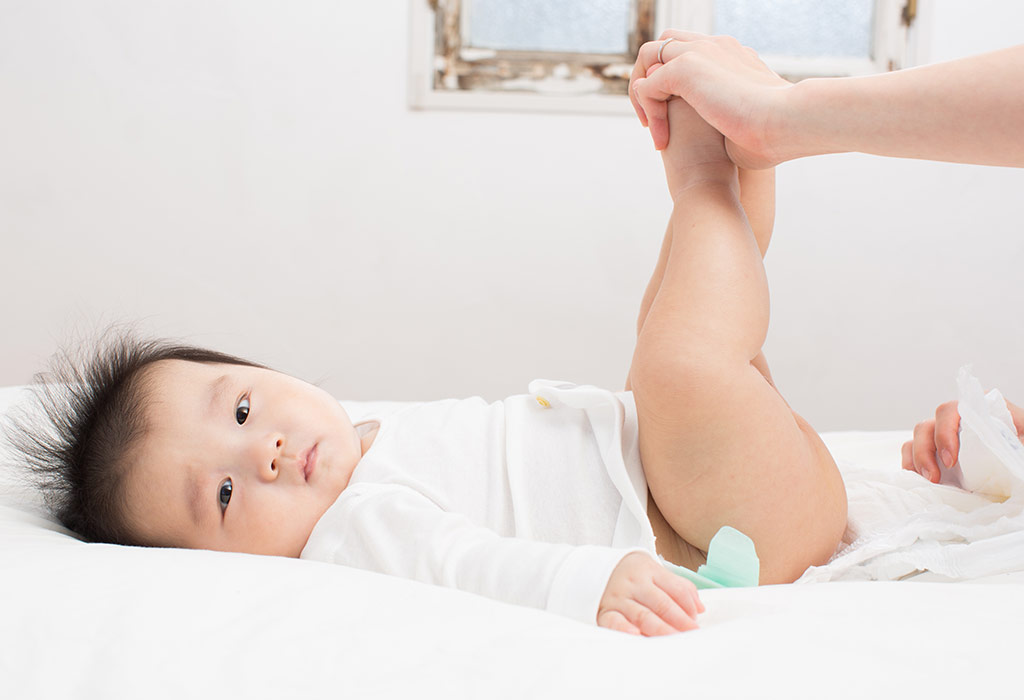 Sử dụng bỉm sai cách có thể dẫn tới hăm tã ở trẻ sơ sinh